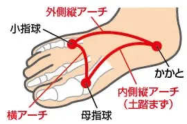 足裏の3つのアーチありますか？